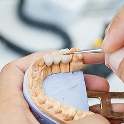 Closeup of dentist working on dental bridge